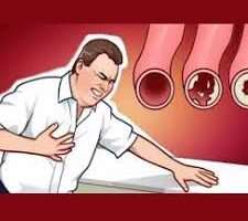 10 Obat Kolesterol Alami bersama Agarillus Herbal