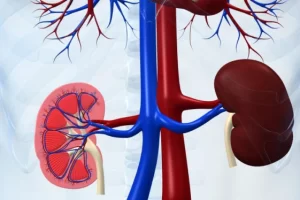 Ingin bebas batu ginjal? Baca cara sederhana ini