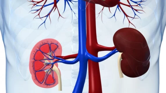 Ingin bebas batu ginjal? Baca cara sederhana ini