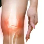 Cara Mudah Sembuh dari Osteoarthritis (Radang Sendi) Tanpa Obat