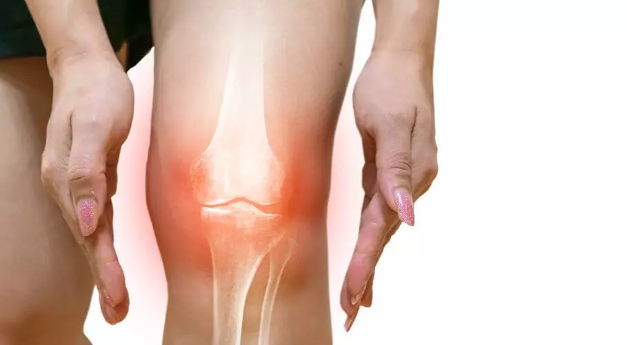 Cara Mudah Sembuh dari Osteoarthritis (Radang Sendi) Tanpa Obat