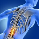 Terapi Agarillus Series Pada Penyakit Osteoporosis