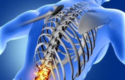 Terapi Agarillus Series Pada Penyakit Osteoporosis